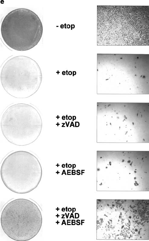 AEBSF（DFP,PMSF無毒替代物）